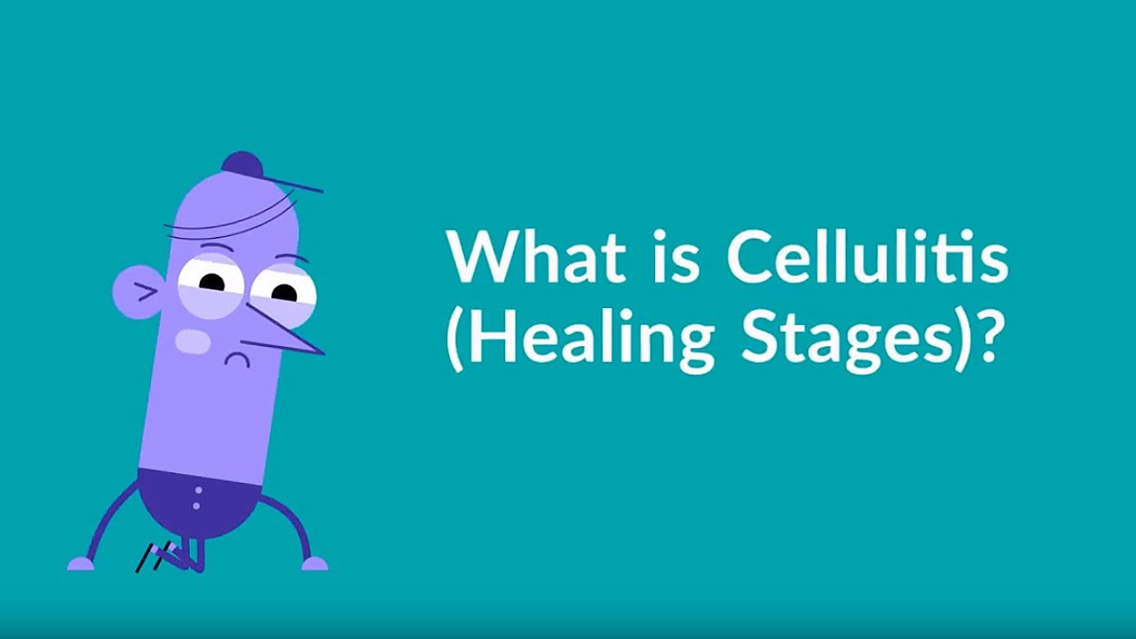 What are the different cellulitis healing stages? | Gymbuddy Now